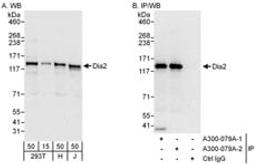 Detection of human Diaphanous 2 by western blot and immunoprecipitation.