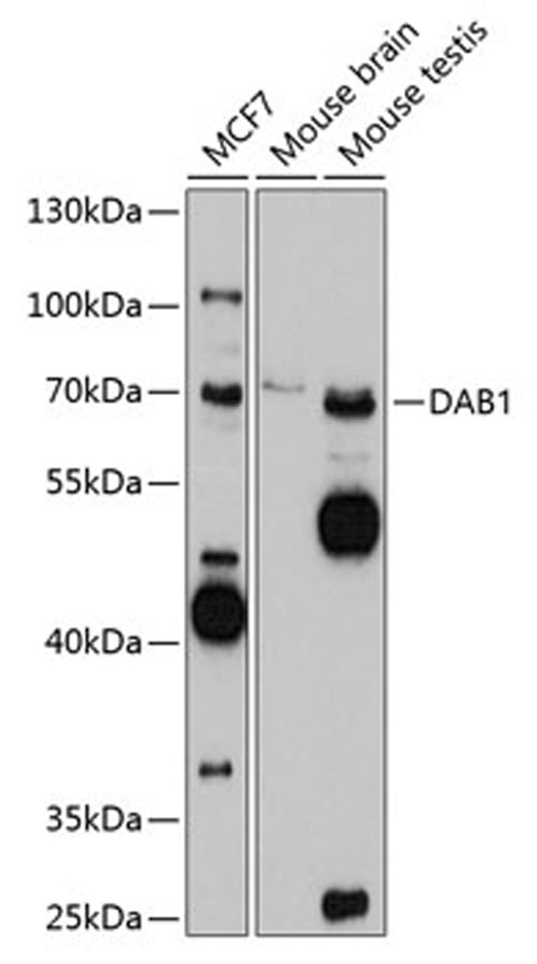 Western blot - DAB1 antibody (A10349)