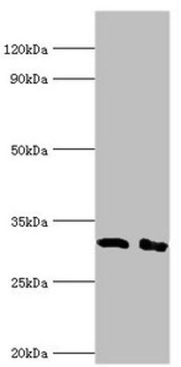 Western blot. All lanes: Lymphocyte function-associated antigen 3 antibody at 2ug/ml. Lane 1: Hela whole cell lysate. Lane 2: Jurkat whole cell lysate. Secondary. Goat polyclonal to rabbit IgG at 1/10000 dilution. Predicted band size: 29, 27, 28 kDa. Observed band size: 29 kDa.