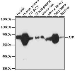 Western blot - AFP antibody (A11865)