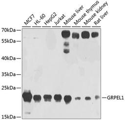 Western blot - GRPEL1 antibody (A4999)