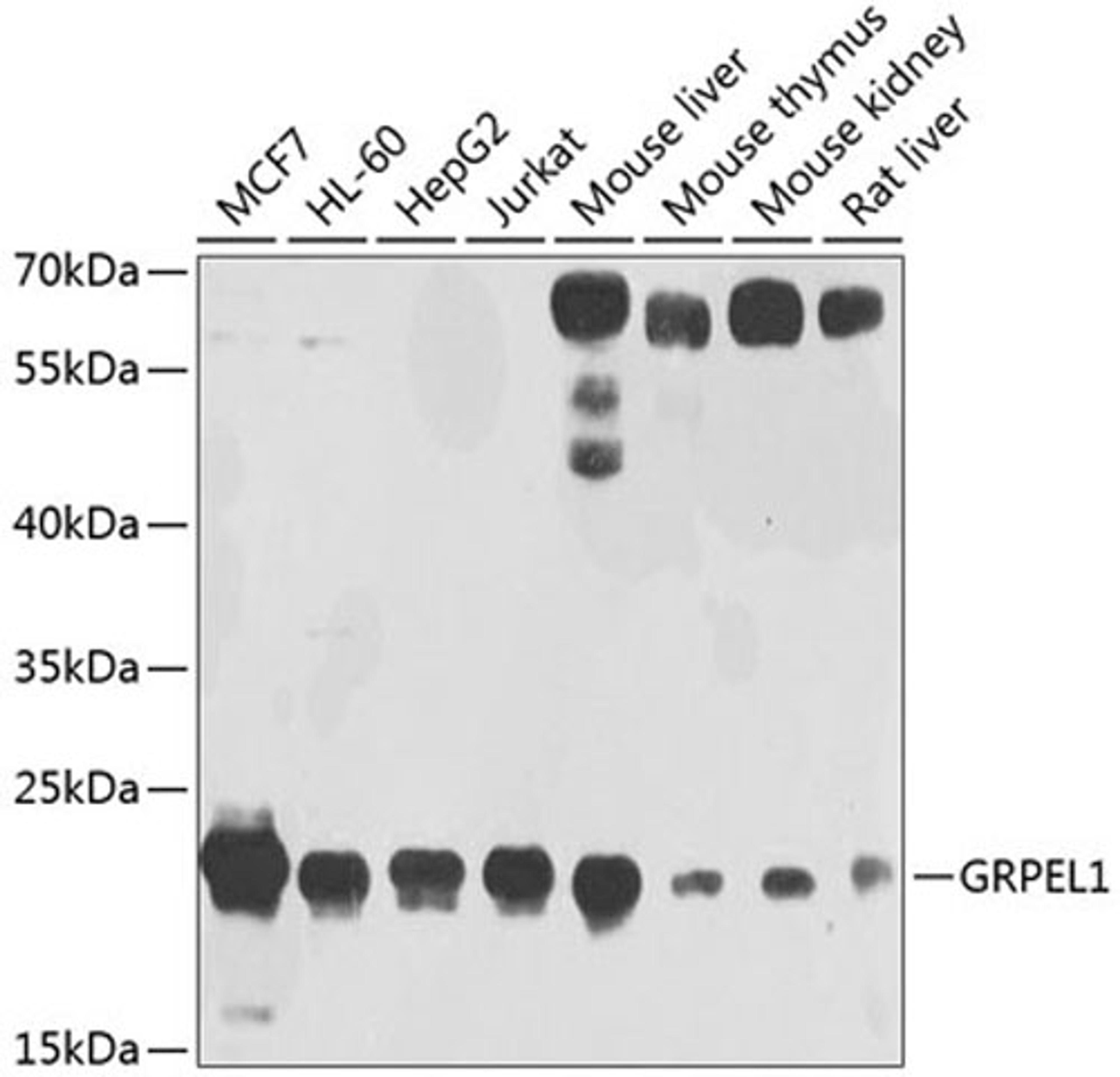 Western blot - GRPEL1 antibody (A4999)