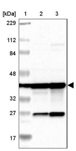 Western Blot: MRPS22 Antibody [NBP1-86787] - Lane 1: Marker [kDa] 229, 112, 84, 48, 32, 27, 17<br/>Lane 2: Human cell line RT-4<br/>Lane 3: Human cell line U-251MG sp