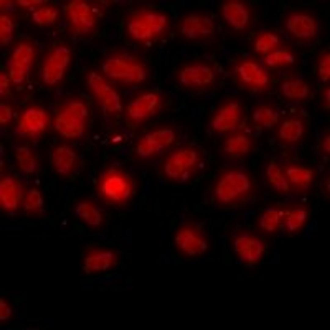 Immunofluorescent analysis of A549 cells using IFRD1 antibody