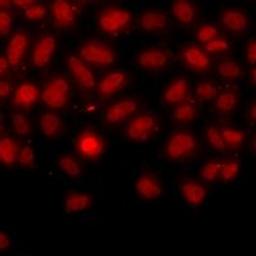 Immunofluorescent analysis of A549 cells using IFRD1 antibody