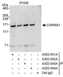 Detection of human CARMA1 by western blot of immunoprecipitates.