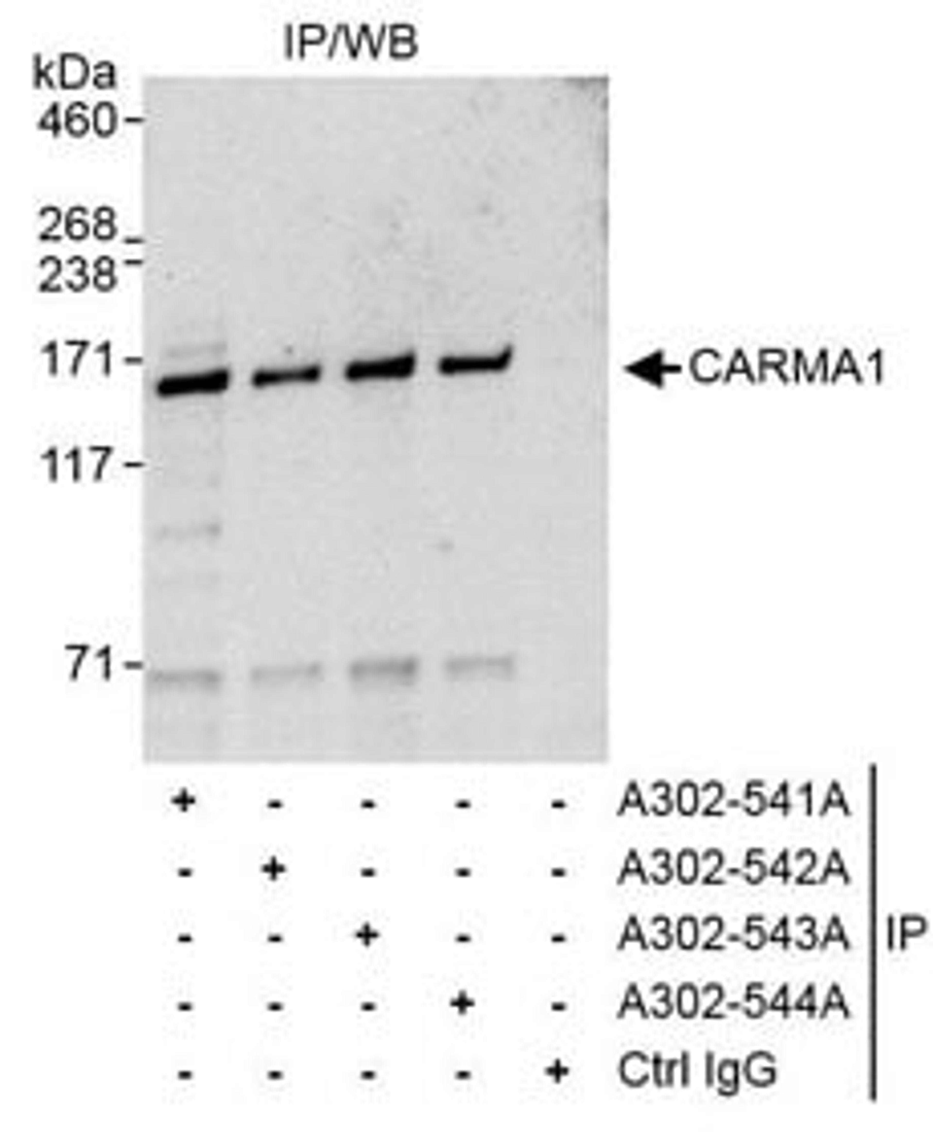 Detection of human CARMA1 by western blot of immunoprecipitates.