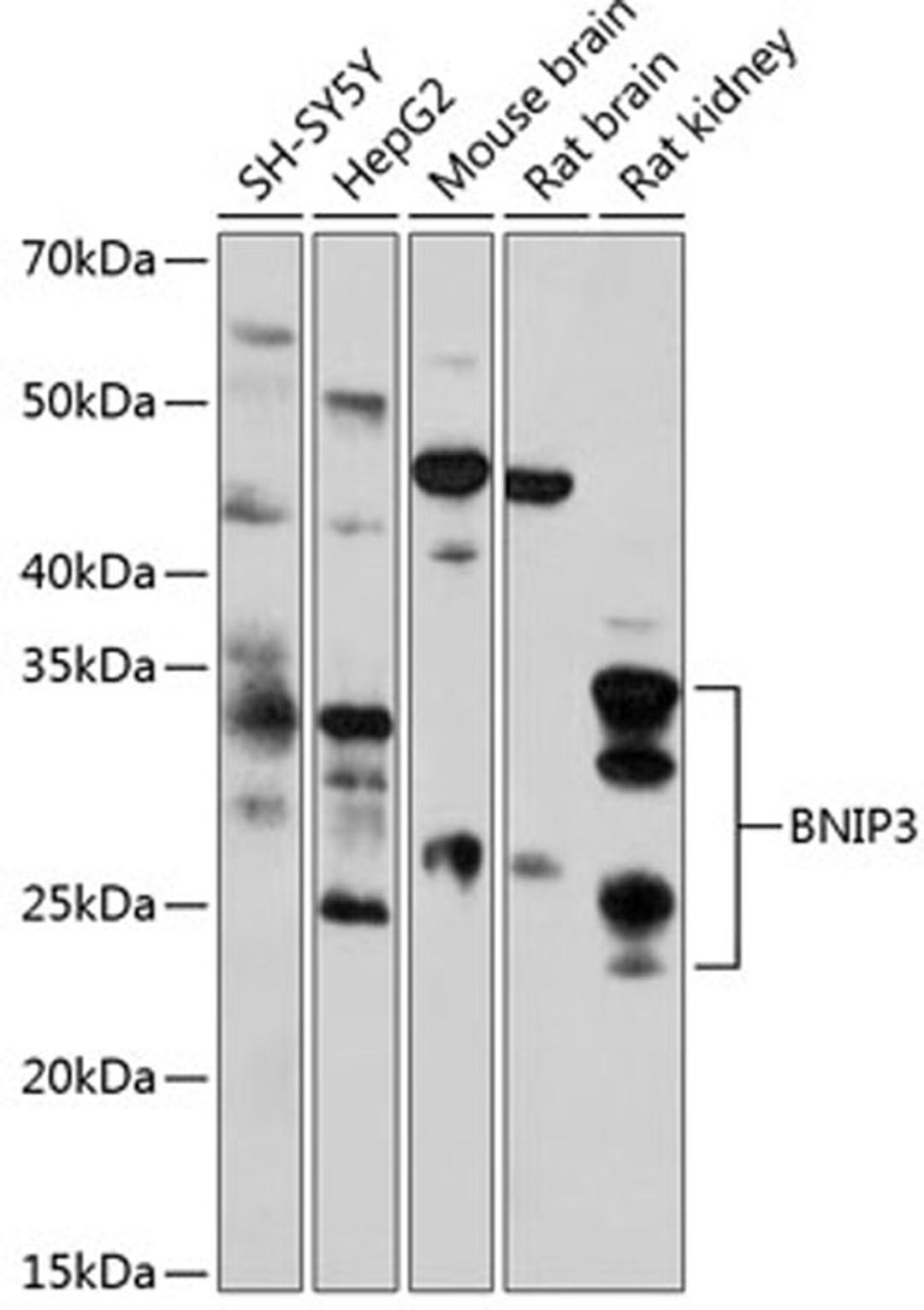 Western blot - BNIP3 antibody (A19593)