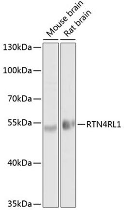 Western blot - RTN4RL1 antibody (A10021)