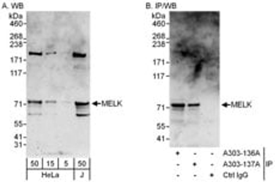 Detection of human MELK by western blot and immunoprecipitation.