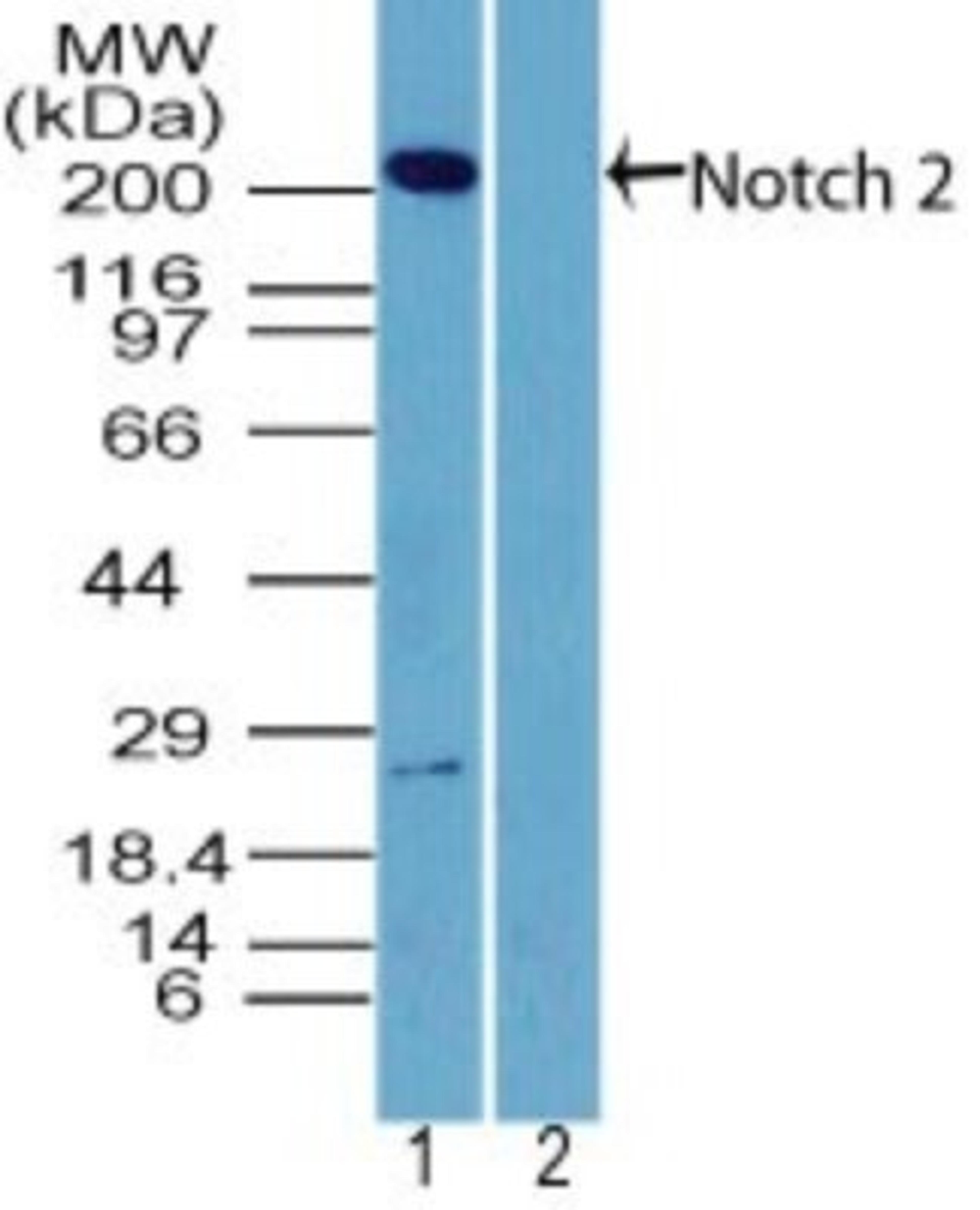 Western Blot: Notch2 Antibody [NBP2-27347] - Analysis of NOTCH2 in human brain lysate in the 1) absence and 2) presence of immunizing peptide using NBP2-27347 at 2 ug/ml. Goat anti-rabbit Ig HRP secondary antibody and PicoTect ECL substrate solution were used for this test.