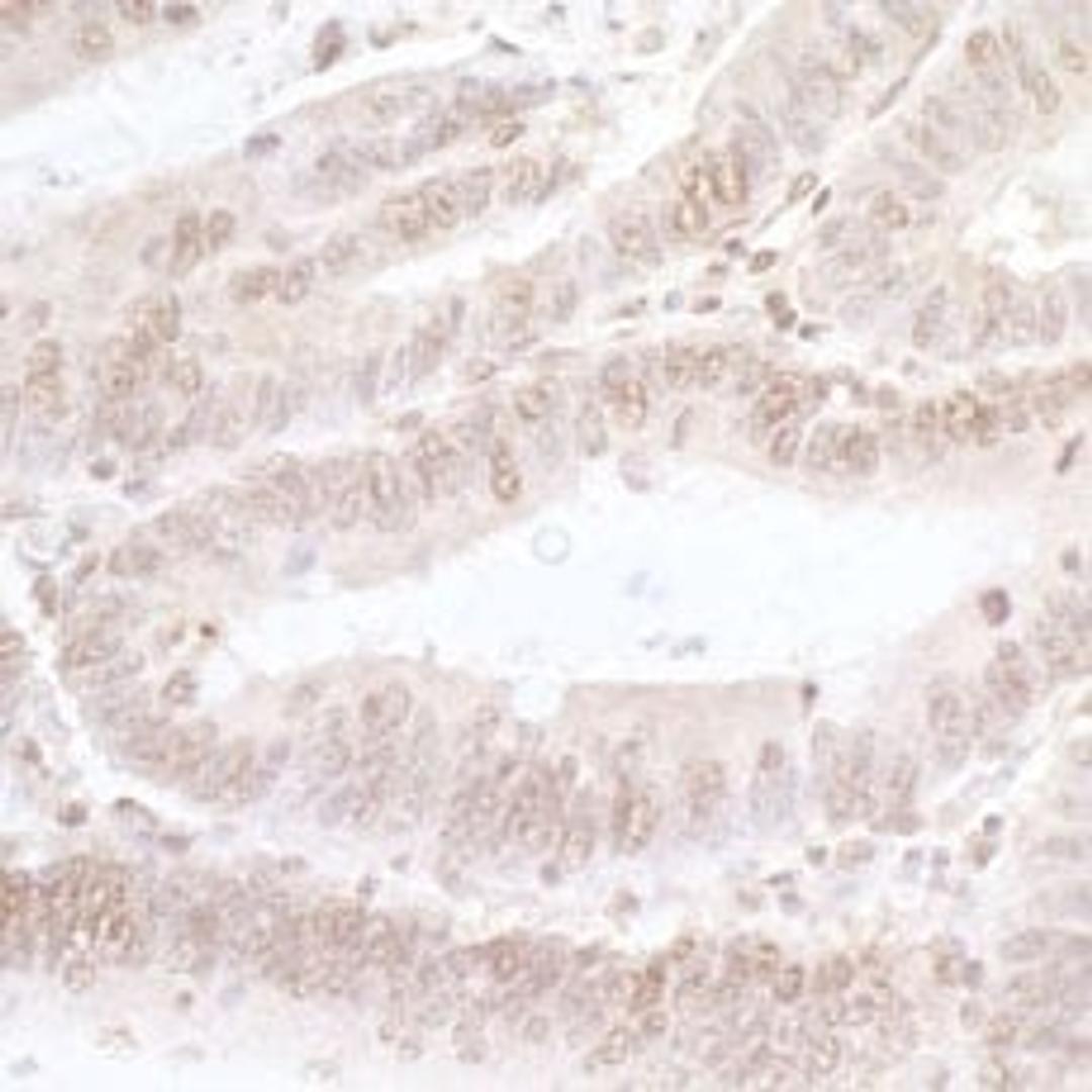 Detection of human NFAT3 by immunohistochemistry.