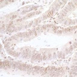 Detection of human NFAT3 by immunohistochemistry.