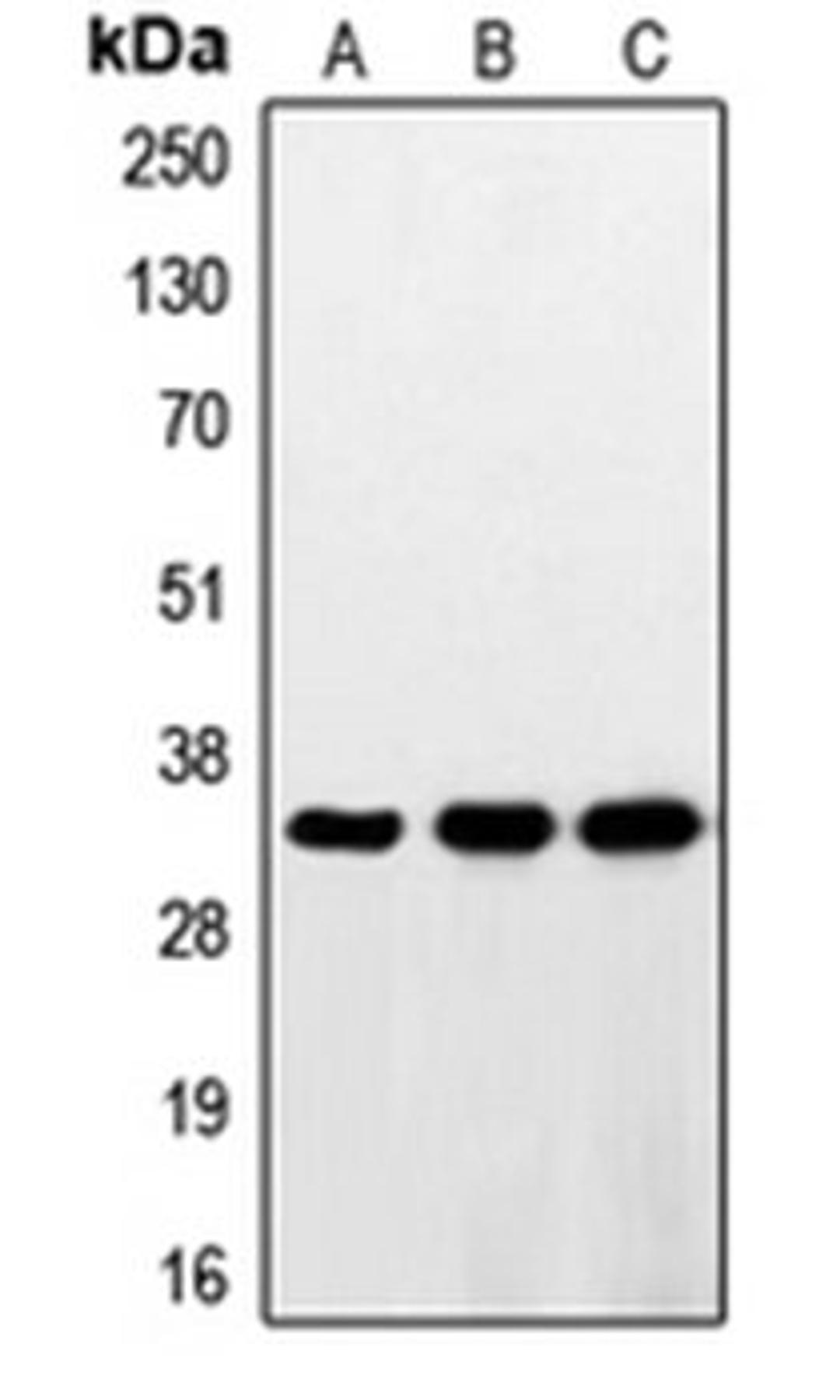 Western blot analysis of HeLa (Lane 1), HepG2 (Lane 2), Jurkat (Lane 3) whole cell lysates using RNF144A antibody