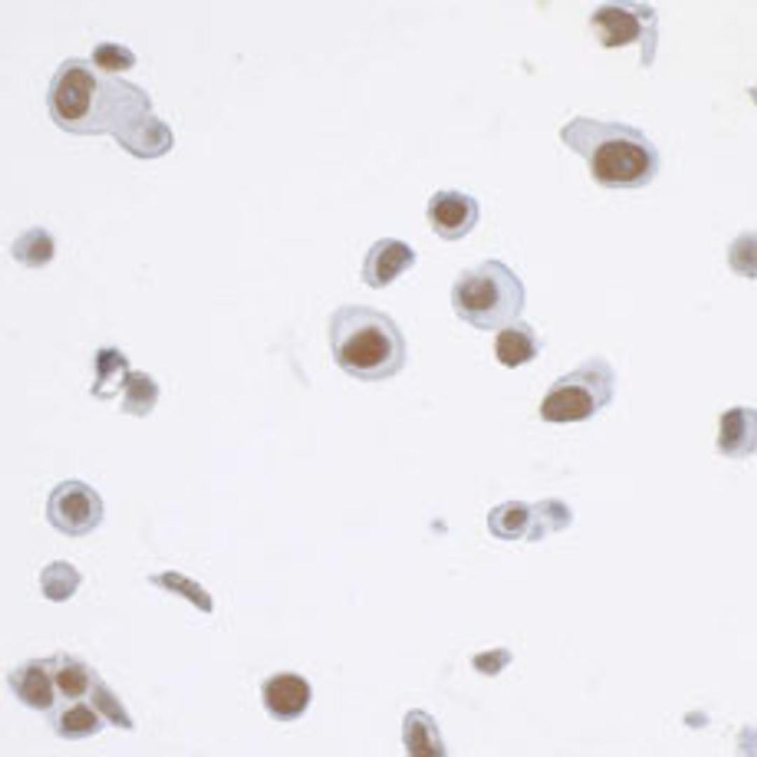 Detection of human CDK7 by immunocytochemistry.