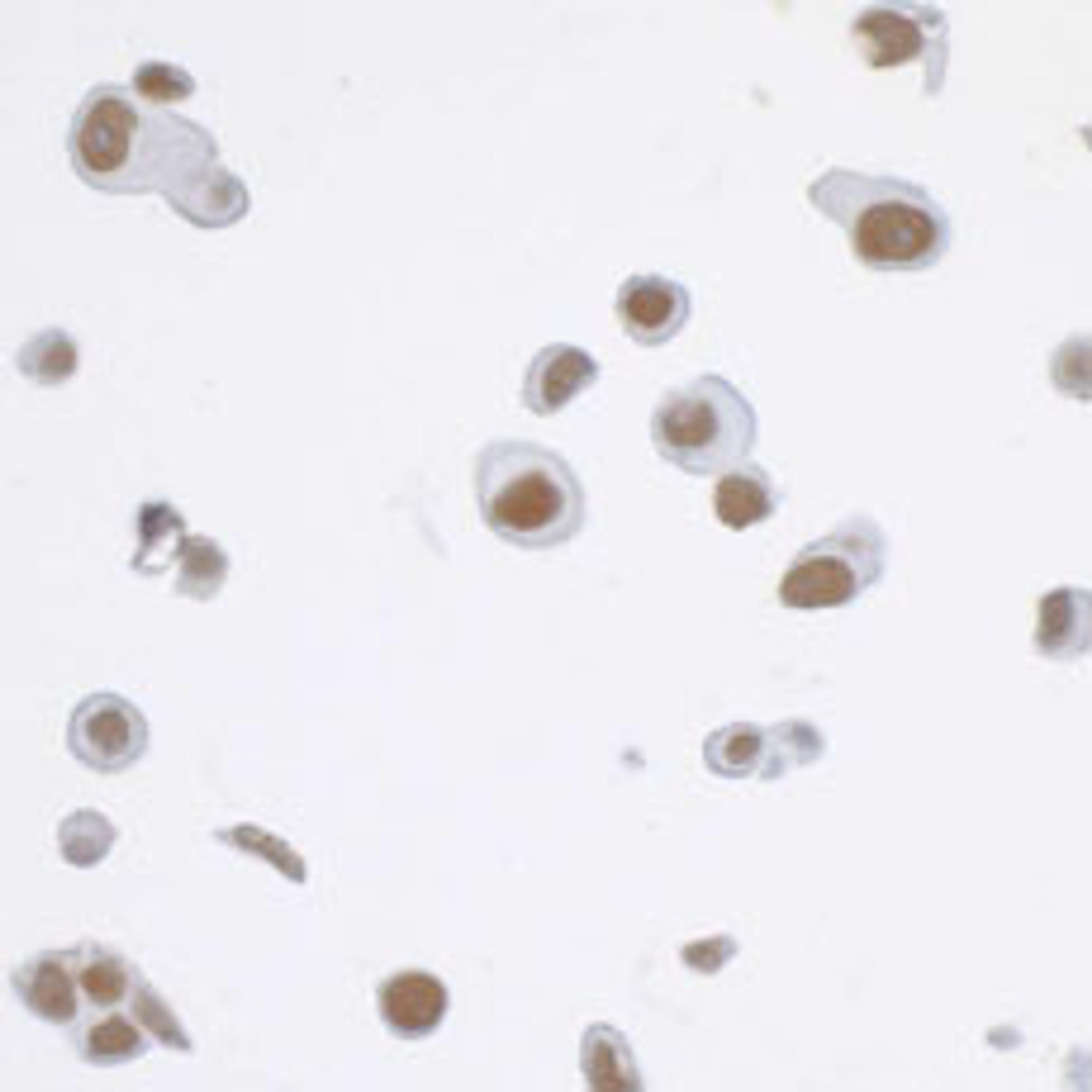 Detection of human CDK7 by immunocytochemistry.