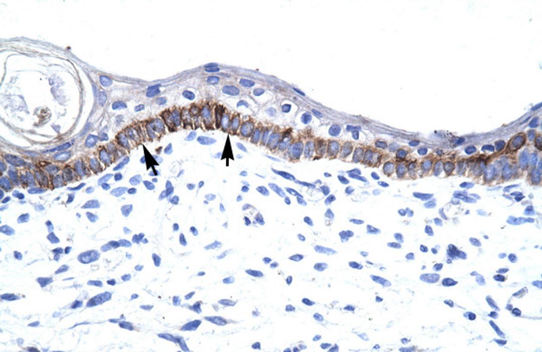 Antibody used in IHC on Human Skin.