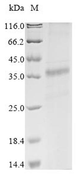 (Tris-Glycine gel) Discontinuous SDS-PAGE (reduced) with 5% enrichment gel and 15% separation gel.