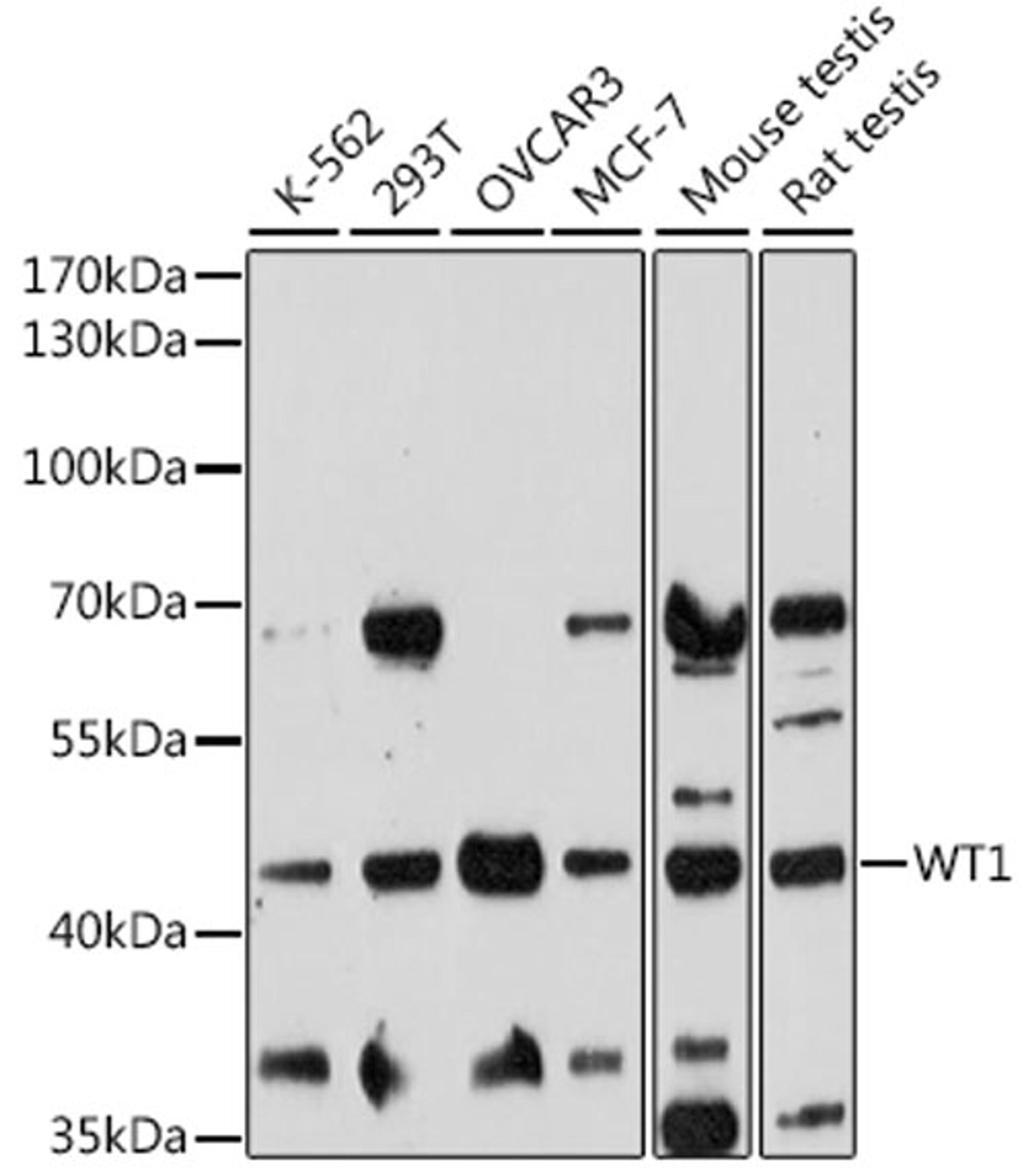 Western blot - WT1 antibody (A16319)