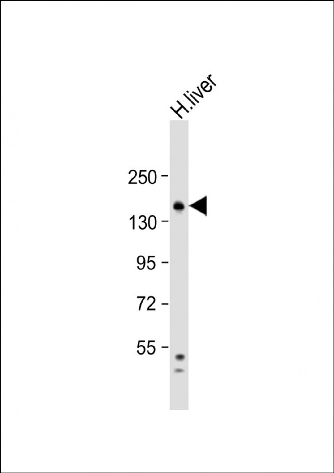 Western Blot at 1:1000 dilution + human liver lysate Lysates/proteins at 20 ug per lane.