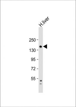 Western Blot at 1:1000 dilution + human liver lysate Lysates/proteins at 20 ug per lane.