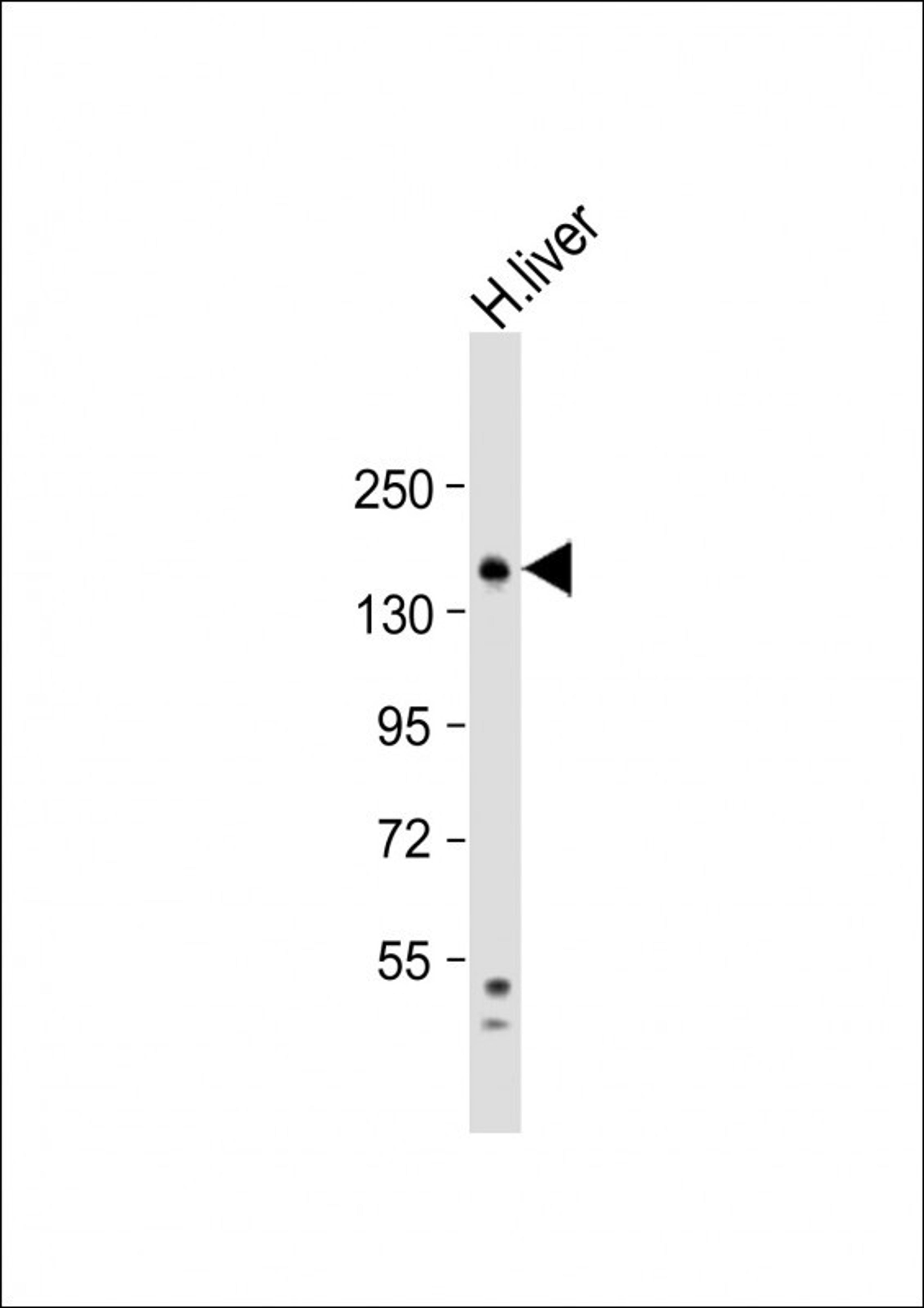 Western Blot at 1:1000 dilution + human liver lysate Lysates/proteins at 20 ug per lane.