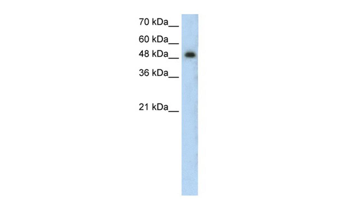 Antibody used in WB on Human Jurkat 0.2-1 ug/ml.