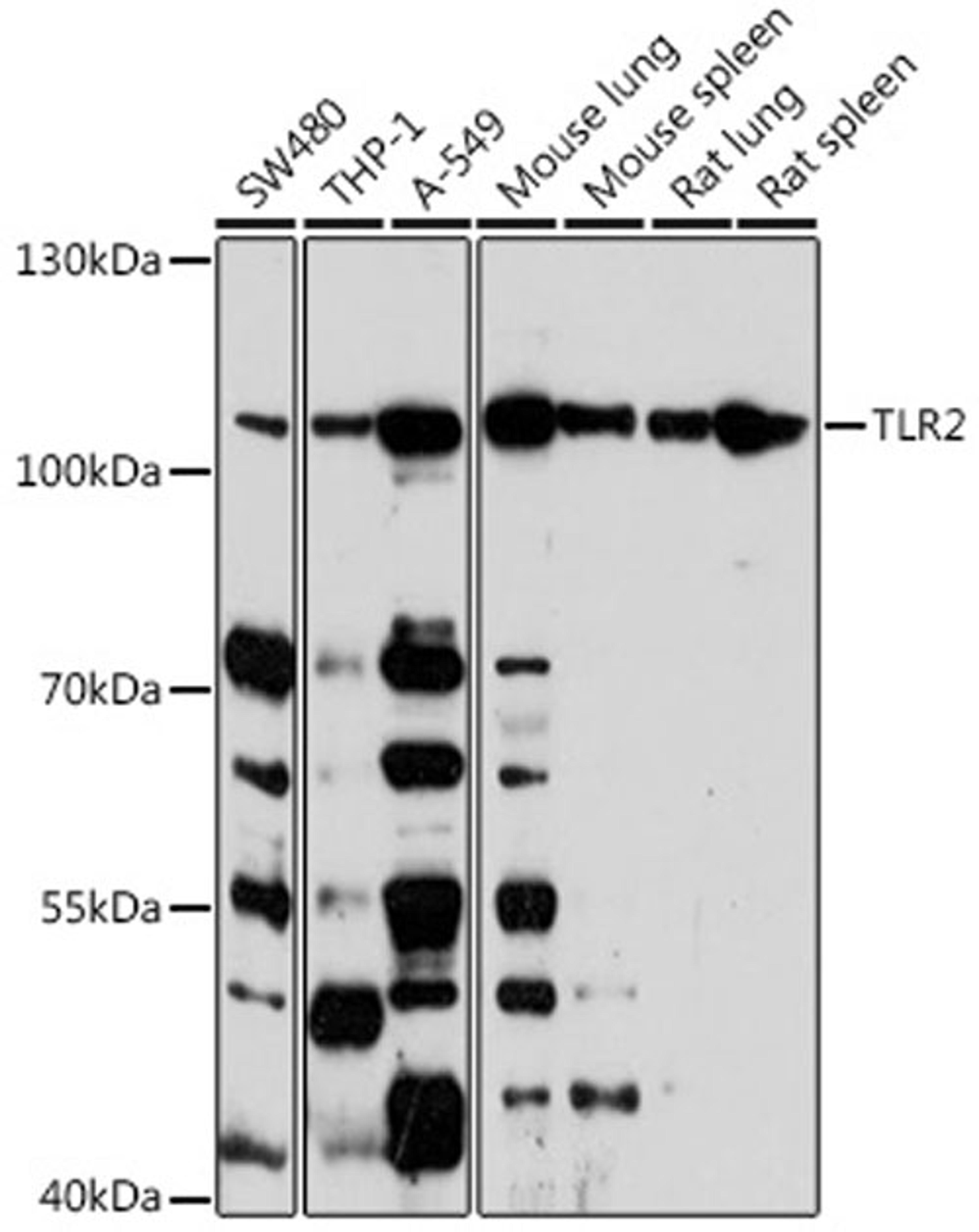 Western blot - TLR2 antibody (A11225)