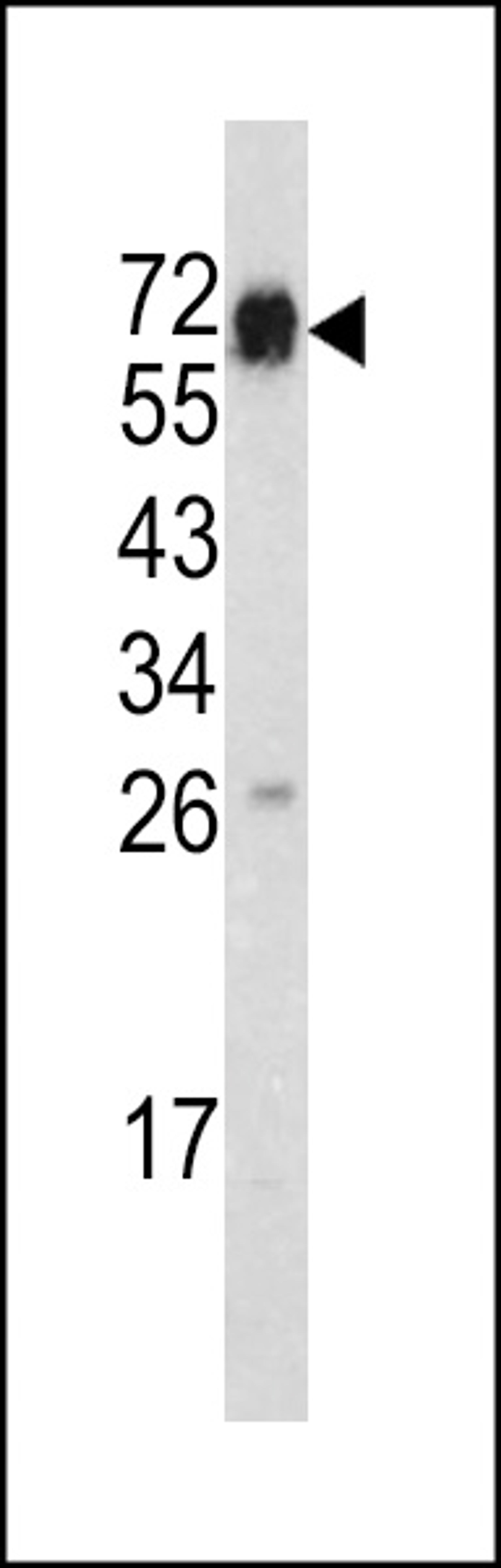 Western blot analysis of in mouse heart tissue lysates (35ug/lane)