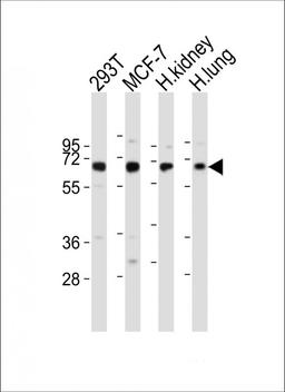 Western Blot at 1:2000 dilution Lane 1: 293T whole cell lysates Lane 2: MCF-7 whole cell lysates Lane 3: human kidney lysates Lane 4: human lung lysates Lysates/proteins at 20 ug per lane.