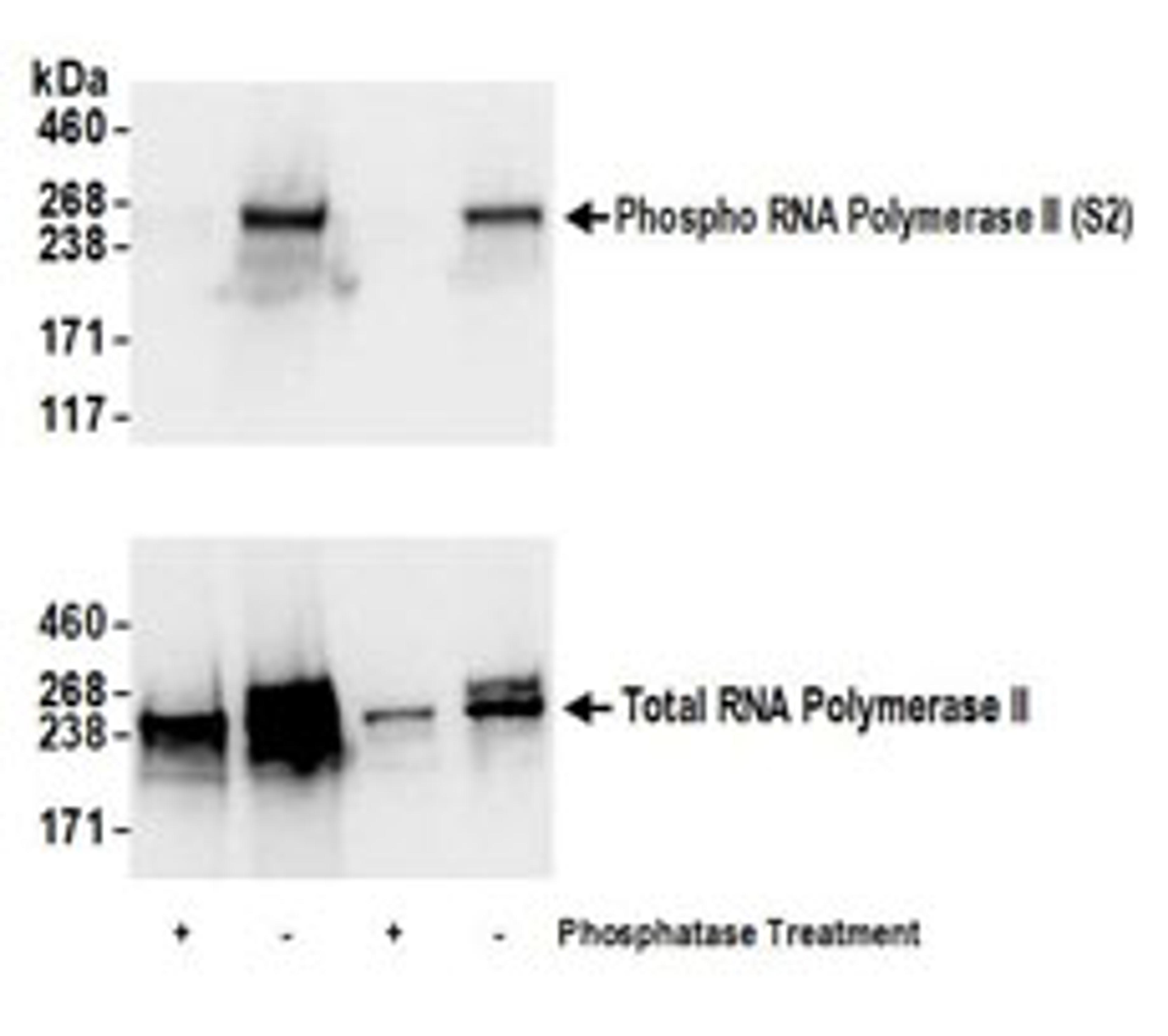 Detection of human Phospho RNA Polymerase II (S2) by western blot.