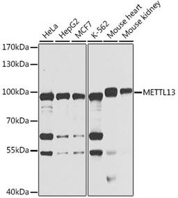 Western blot - METTL13 antibody (A7111)