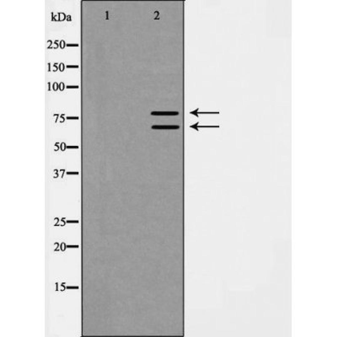 Western blot analysis of LoVo cell lysate using Ku70/80 antibody