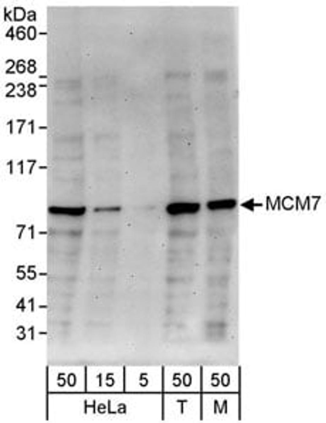 Detection of human and mouse MCM7 by western blot.