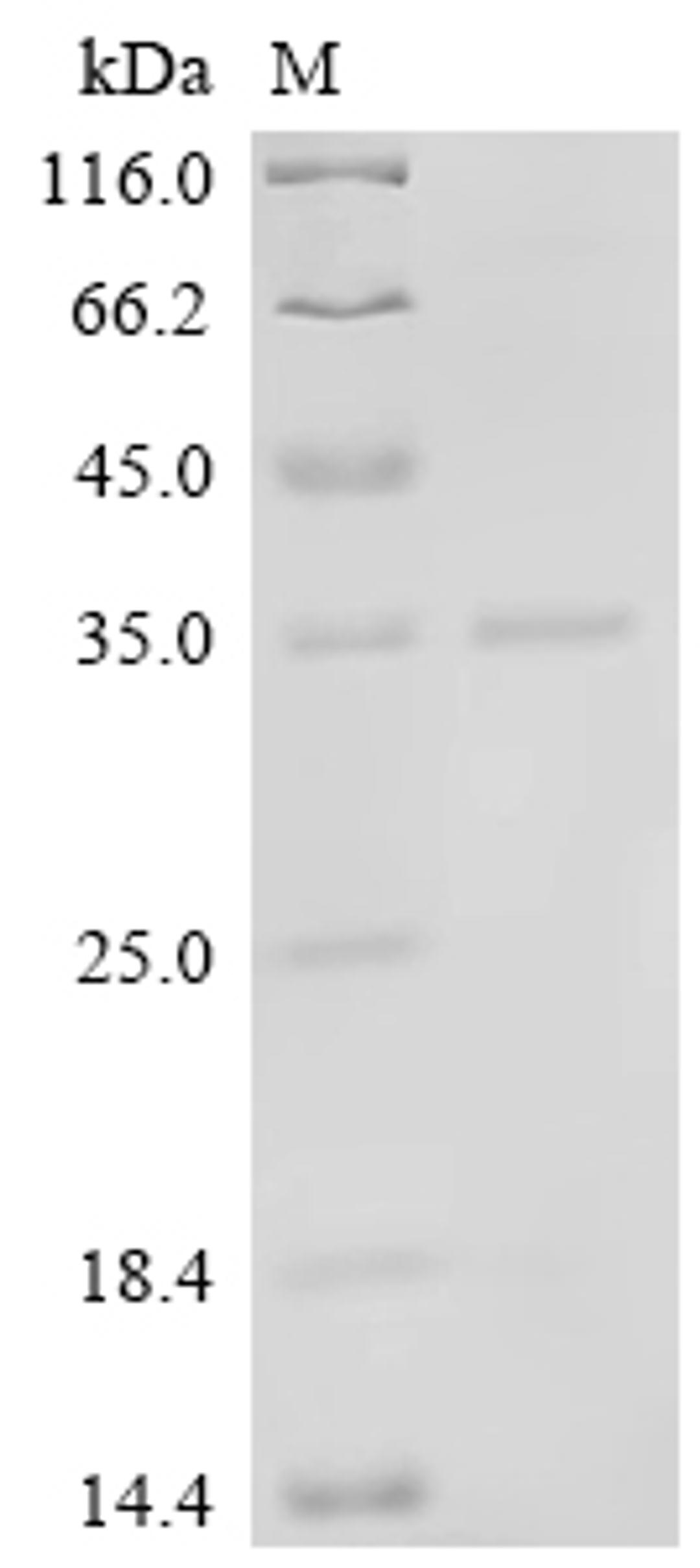 (Tris-Glycine gel) Discontinuous SDS-PAGE (reduced) with 5% enrichment gel and 15% separation gel.