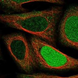 Immunofluorescence: LETM2 Antibody [NBP1-83563] -  Staining of human cell line U-2 OS shows positivity in nucleus & cytoplasm.