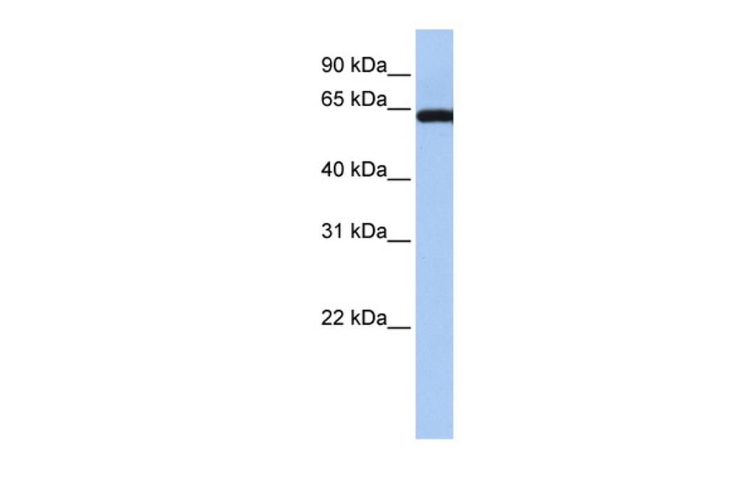 Antibody used in WB on Human Brain at 0.2-1 ug/ml.