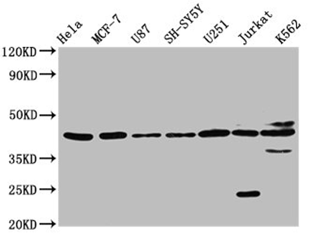 Western Blot. Positive WB detected in: Hela whole cell lysate, MCF-7 whole cell lysate, U87 whole cell lysate, SH-SY5Y whole cell lysate, U251 whole cell lysate, Jurkat whole cell lysate, K562 whole cell lysate. All lanes: NPY2R antibody at 3.2µg/ml. Secondary. Goat polyclonal to rabbit IgG at 1/50000 dilution. Predicted band size: 43 kDa. Observed band size: 43 kDa
