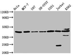 Western Blot. Positive WB detected in: Hela whole cell lysate, MCF-7 whole cell lysate, U87 whole cell lysate, SH-SY5Y whole cell lysate, U251 whole cell lysate, Jurkat whole cell lysate, K562 whole cell lysate. All lanes: NPY2R antibody at 3.2µg/ml. Secondary. Goat polyclonal to rabbit IgG at 1/50000 dilution. Predicted band size: 43 kDa. Observed band size: 43 kDa