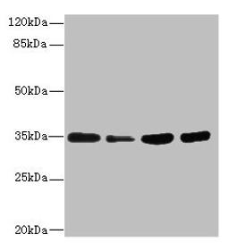 Western blot. All lanes: UFD1 antibody at 3.22µg/ml. Lane 1: HepG2 whole cell lysate. Lane 2: Raji whole cell lysate. Lane 3: MCF-7 whole cell lysate. Lane 4: Jurkat whole cell lysate. Secondary. Goat polyclonal to rabbit IgG at 1/10000 dilution. Predicted band size: 35, 39, 30 kDa. Observed band size: 35 kDa