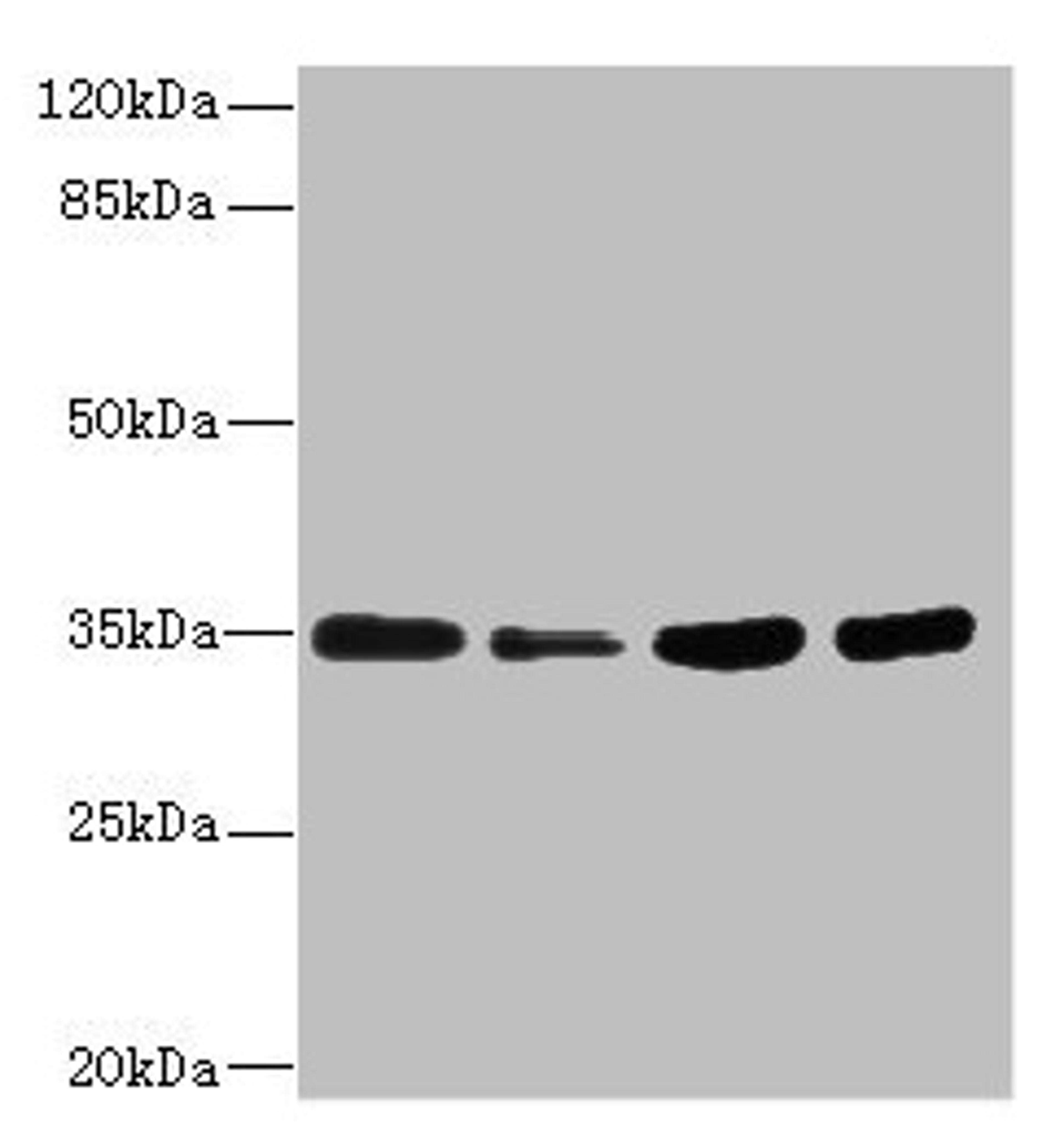 Western blot. All lanes: UFD1 antibody at 3.22µg/ml. Lane 1: HepG2 whole cell lysate. Lane 2: Raji whole cell lysate. Lane 3: MCF-7 whole cell lysate. Lane 4: Jurkat whole cell lysate. Secondary. Goat polyclonal to rabbit IgG at 1/10000 dilution. Predicted band size: 35, 39, 30 kDa. Observed band size: 35 kDa