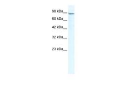 Antibody used in WB on Human Jurkat cells at 2.5 ug/ml.