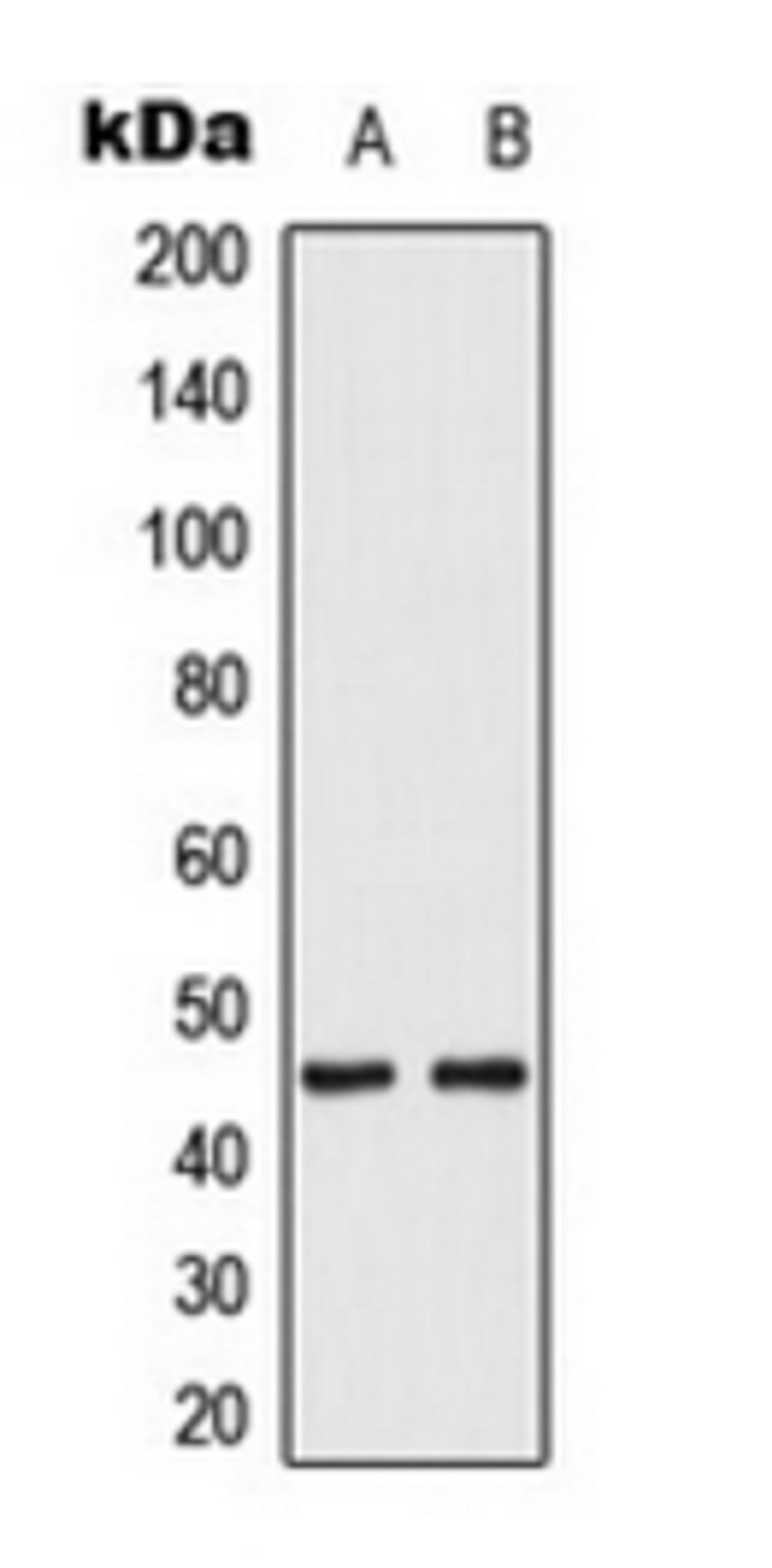 Western blot analysis of HeLa EGF-treated (Lane 1), K562 (Lane 2) whole cell lysates using MKK1/2 (phospho-S222/226) antibody