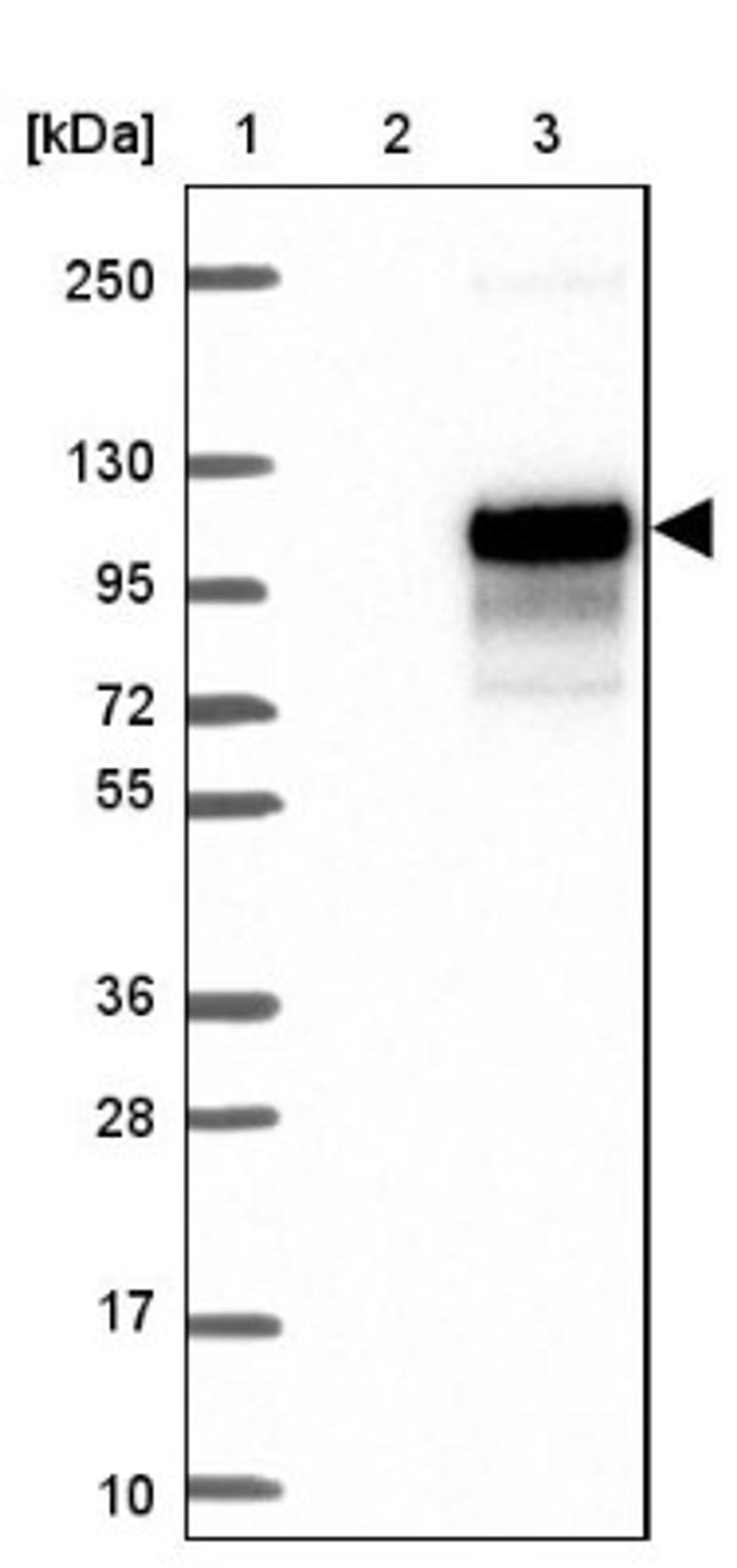 Western Blot: IL-1 RAPL2/IL-1 R9 Antibody [NBP1-81598] - Lane 1: Marker [kDa] 250, 130, 95, 72, 55, 36, 28, 17, 10<br/>Lane 2: Negative control (vector only transfected HEK293T lysate)<br/>Lane 3: Over-expression lysate (Co-expressed with a C-terminal myc-DDK tag (~3.1 kDa) in mammalian HEK293T cells, LY413774)