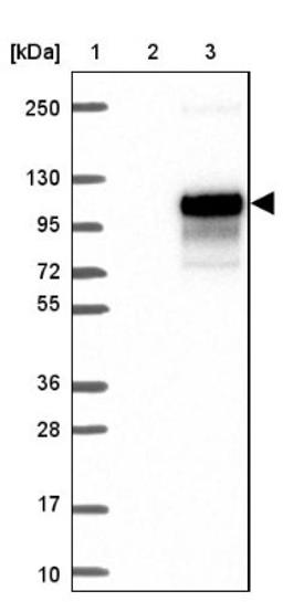 Western Blot: IL-1 RAPL2/IL-1 R9 Antibody [NBP1-81598] - Lane 1: Marker [kDa] 250, 130, 95, 72, 55, 36, 28, 17, 10<br/>Lane 2: Negative control (vector only transfected HEK293T lysate)<br/>Lane 3: Over-expression lysate (Co-expressed with a C-terminal myc-DDK tag (~3.1 kDa) in mammalian HEK293T cells, LY413774)