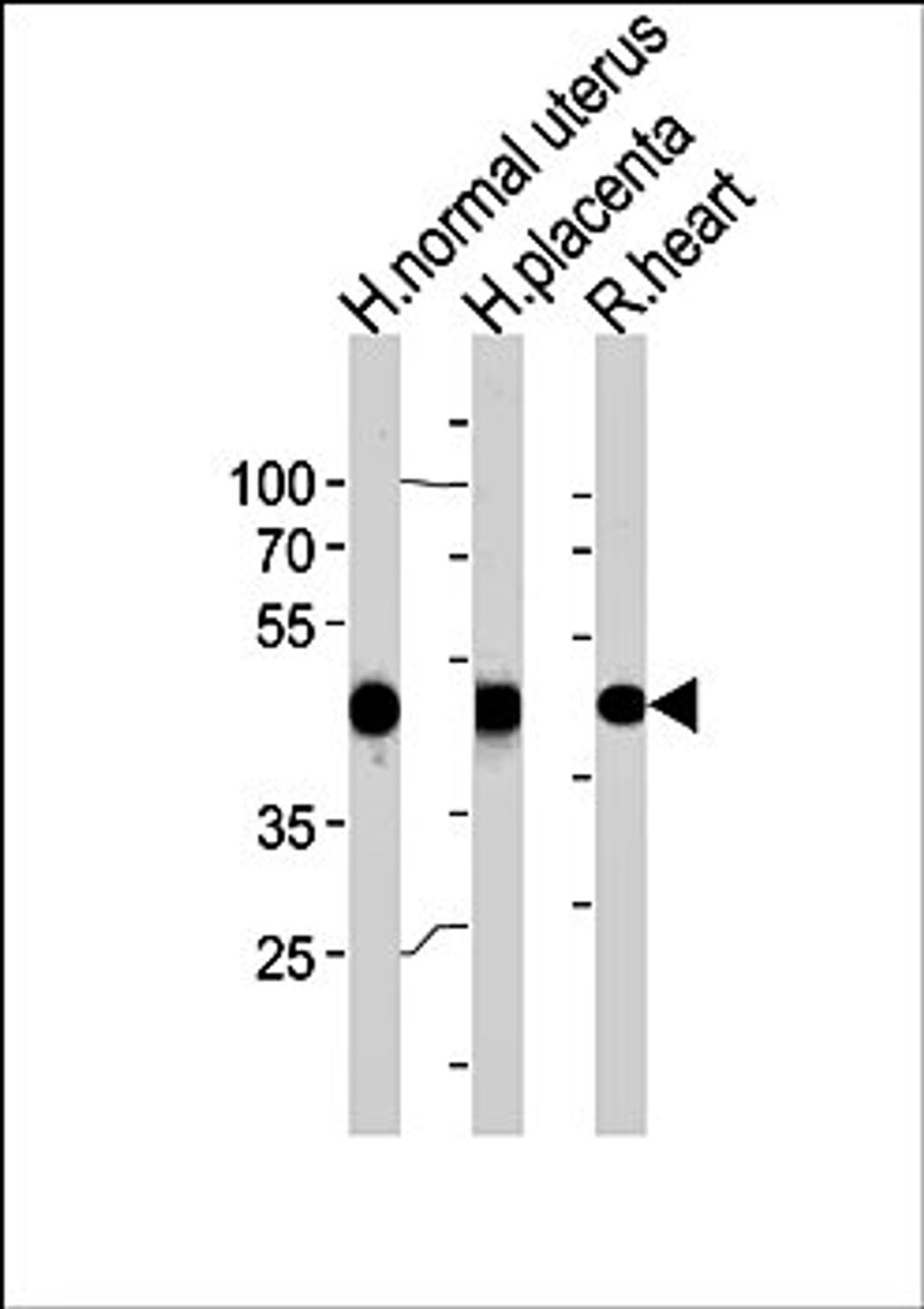 Western blot analysis of human normal uterus and placenta, rat heart tissue lysates (35ug/lane) using ACTA1 (C-term) antibody