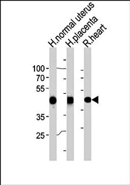 Western blot analysis of human normal uterus and placenta, rat heart tissue lysates (35ug/lane) using ACTA1 (C-term) antibody