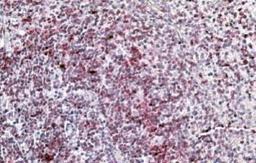 Immunohistochemistry-Paraffin: Integrin alpha L/CD11a Antibody [NBP1-51967] - (3.8ug/ml) Staining of paraffin embedded Human Spleen. Steamed antigen retrieval with citrate buffer pH 6, AP-staining.