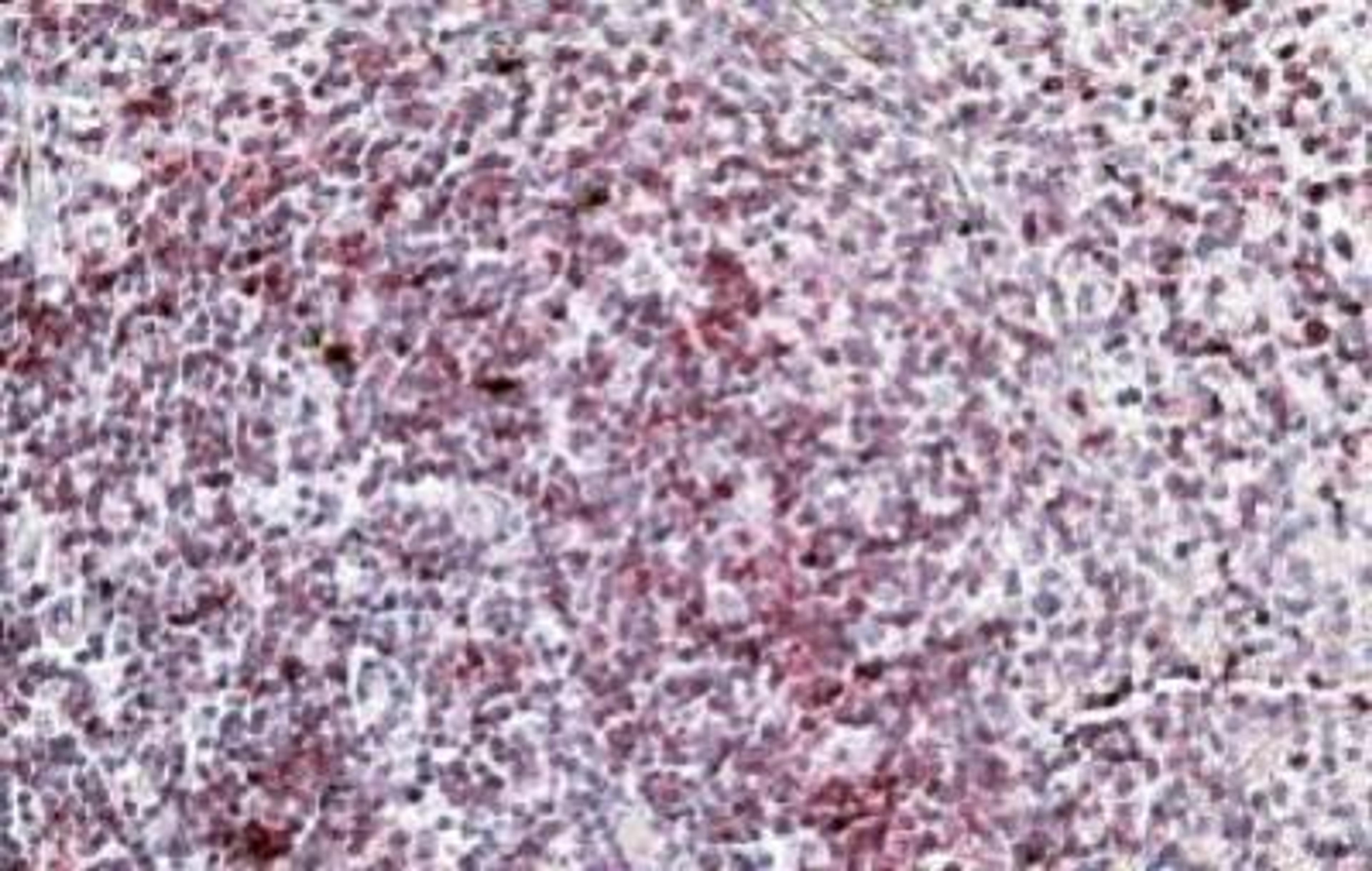 Immunohistochemistry-Paraffin: Integrin alpha L/CD11a Antibody [NBP1-51967] - (3.8ug/ml) Staining of paraffin embedded Human Spleen. Steamed antigen retrieval with citrate buffer pH 6, AP-staining.