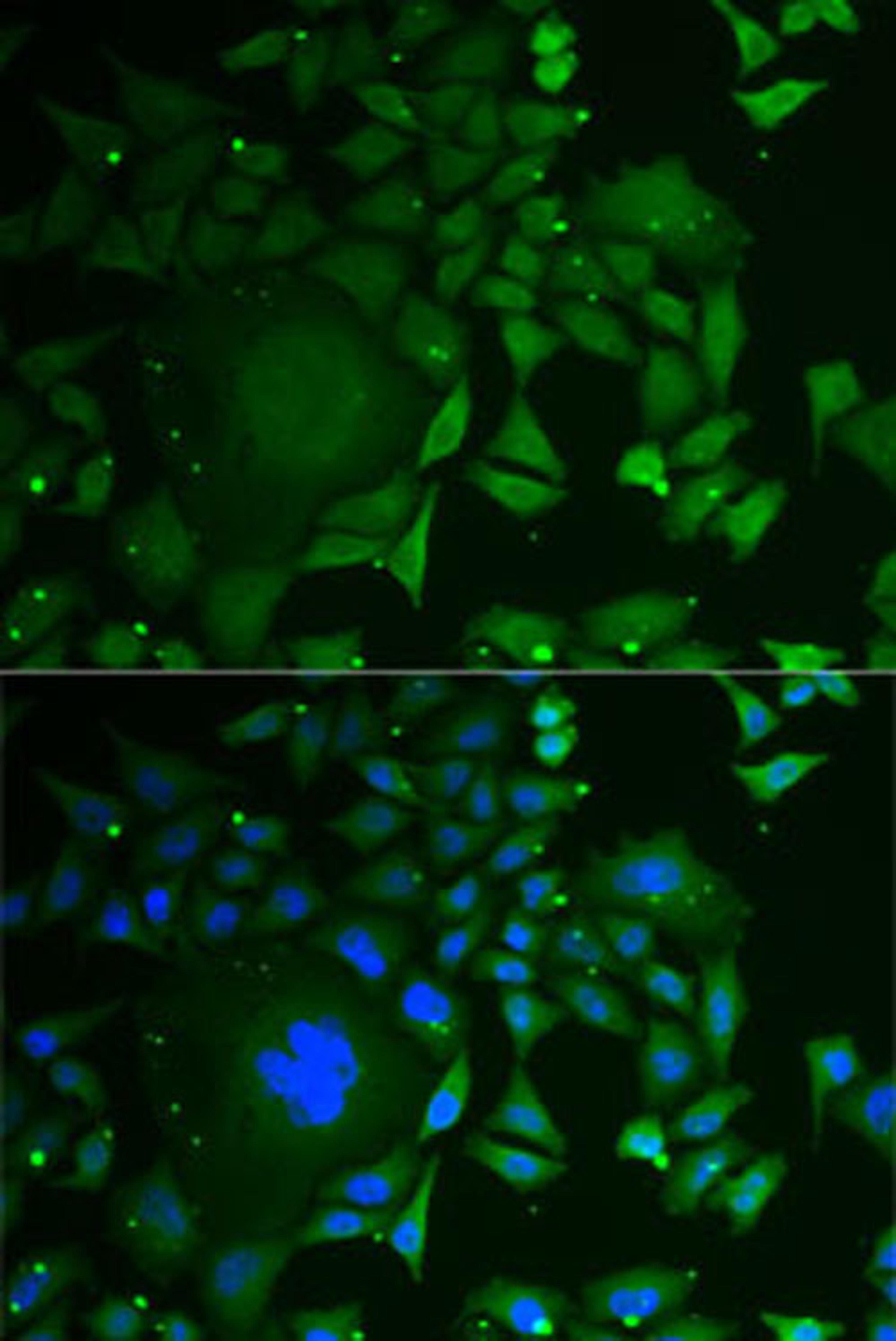 Immunofluorescence - C1D antibody (A6448)